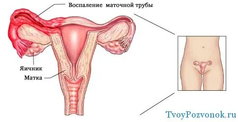 Після місячних болить низ живота і поперек: причини і симптоми (місячних) болить живіт після місячних
