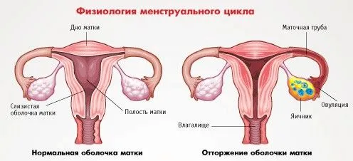 Може бути затримка місячних при циститі і які причини (місячні) місячних
