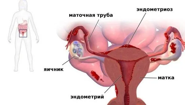 внизу живота