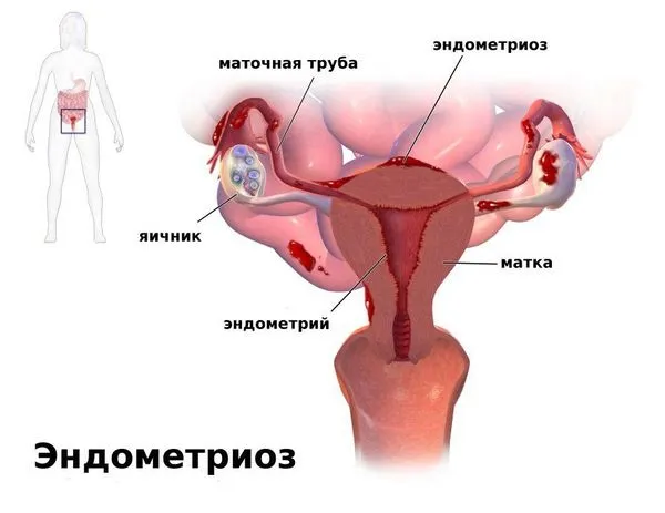 місячні