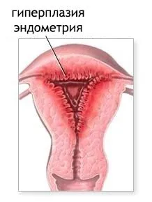 місячних