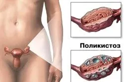 менструального циклу