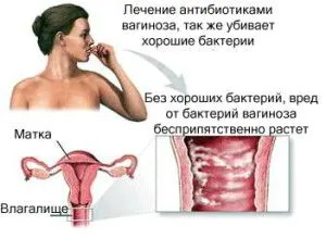 Сірі виділення після місячних (менструального циклу) менструального циклу