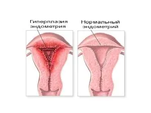 місячні