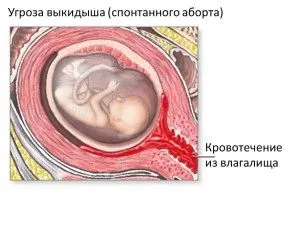 гормональний фон