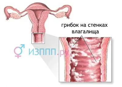 менструальним циклом