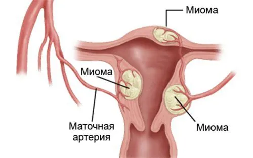 симптоми затримки місячних