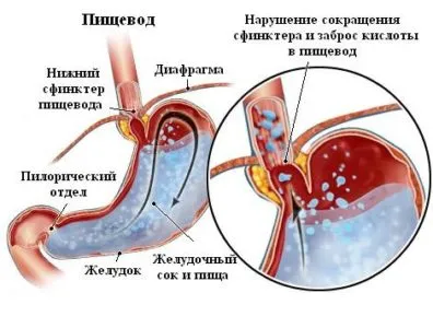 eructații