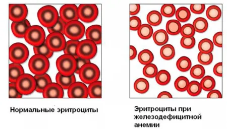 Ce fructe cresc hemoglobina în sânge în timpul sarcinii, pentru femei