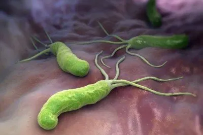 Бактерии Helicobacter pylori в стомаха симптоми, лечение