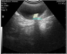 Uzi, diagnosztika, ultrahang, állatok, állatgyógyászat, állatorvosi ultrahang, műalkotás zaj