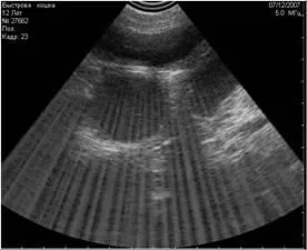 Uzi, diagnosticare, ecografie, animale, medicina veterinara, ecografie veterinară, zgomot artefact