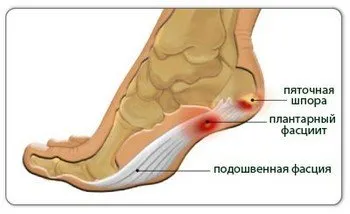 Какво означава болка в петата?