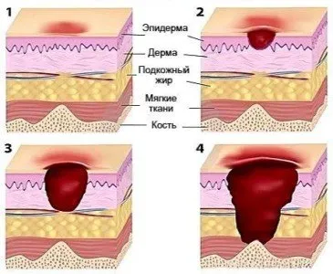 залежаване