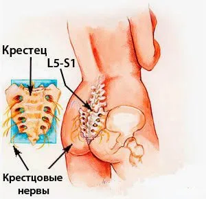 Защо се появява болка в сакрума