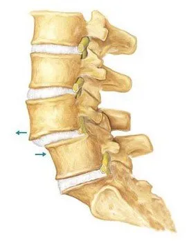 Спондилолистеза причини, симптоми, лечение