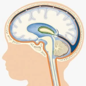 Хидроцефалия на мозъка при новородени - методи за лечение и какво заплашва бебето