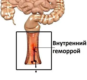 температура