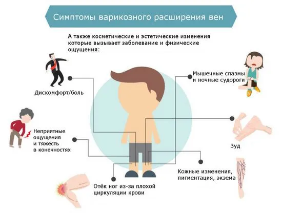 Признаци на разширени вени, как да разберете, че болестта се развива