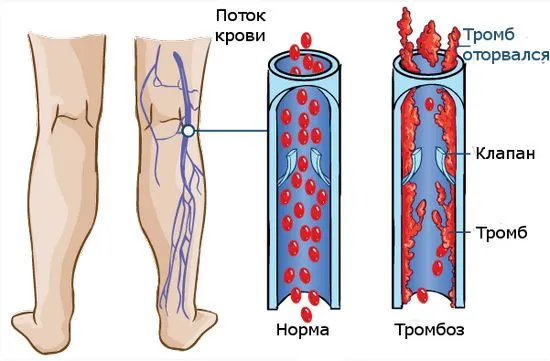 причини