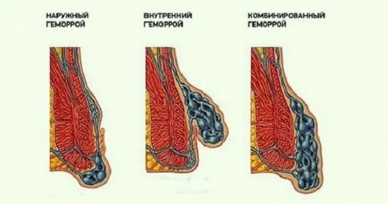 комбинирани