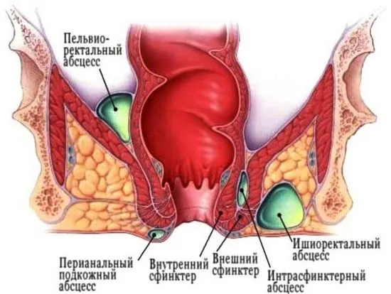 операция