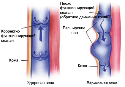 разширени