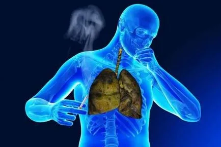 Figyelem! Kétirányú bronchitis - veszélyes betegség