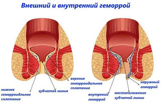 хронични