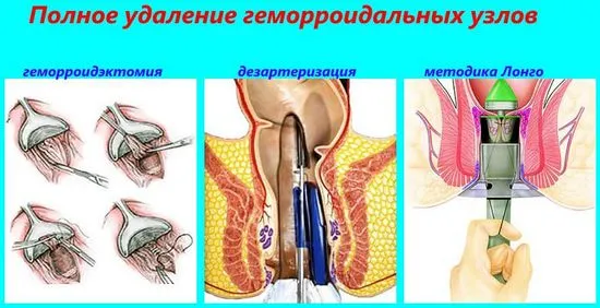 премахват