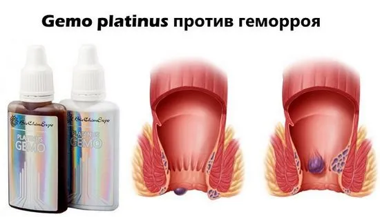 Gemo Platinus си струва да се купи или не