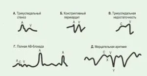 странични