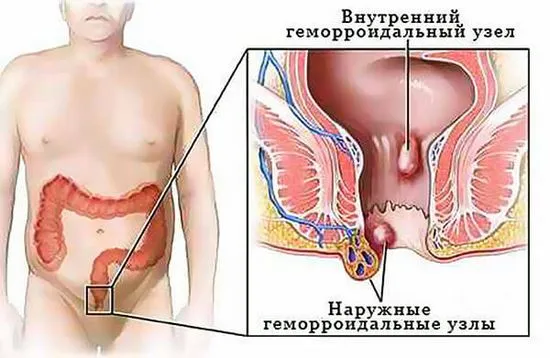 ануса