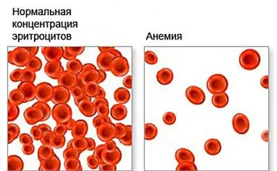 Зелени изпражнения (изпражнения) при възрастен - причини