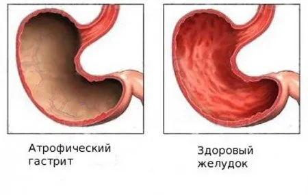 стомаха