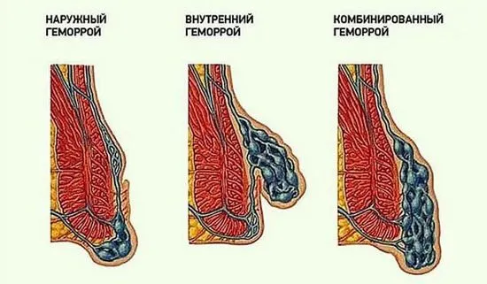 основните