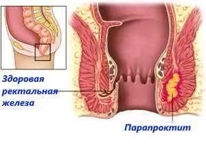 лекуваме