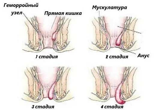 операция