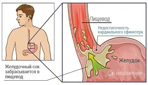 сърдечна