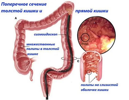 лекувани