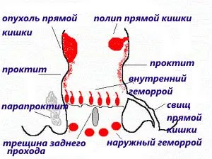 причини