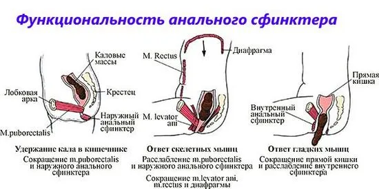 Симптоми на спазъм на аналния сфинктер