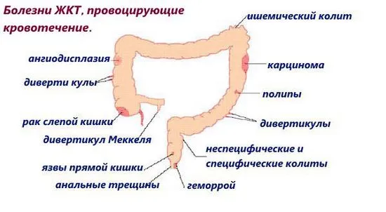 опасниположението