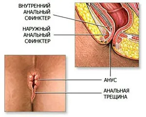 кървене