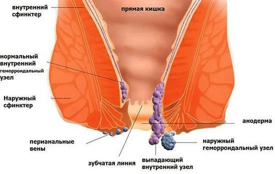 Какви лекарства лекуват хемороиди