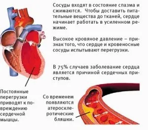 Хипертония, високо кръвно налягане, нейното лечение