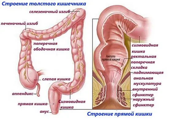 хемороиди