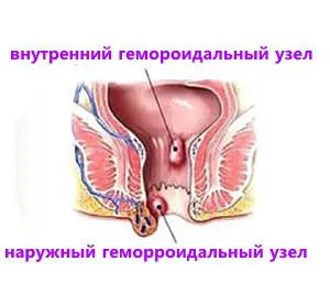 проблема