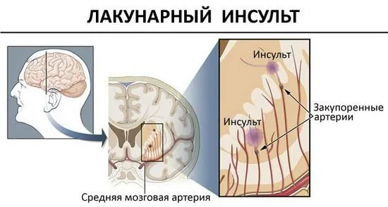 причини