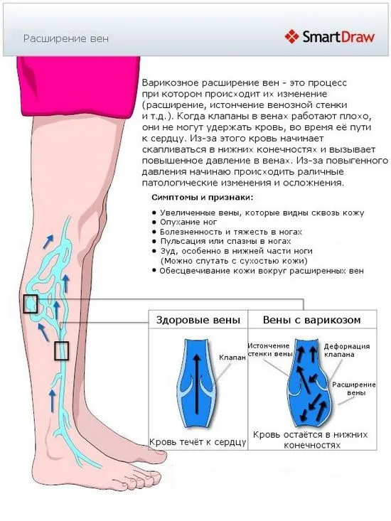 Как да използвате Almag за разширени вени и е безопасно